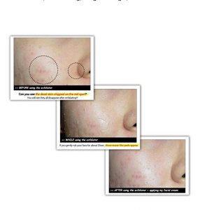 Vitamin C Grapefruit Exfoliator with Natural Ingredients - Image 5
